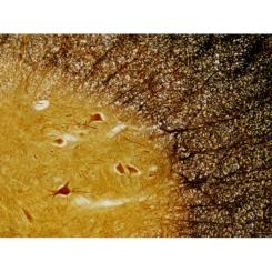 Набор микропрепаратов Bresser Histology 30 шт (5985000) Фото 2